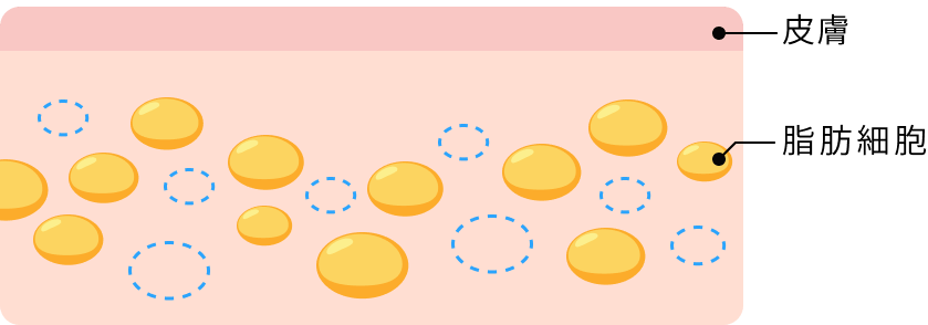 脂肪が死滅することでリバウンドを防ぐことができます