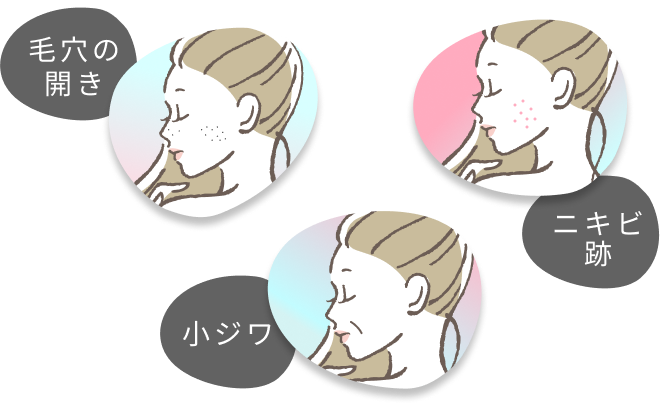 毛穴の開き、ニキビ跡、小ジワ